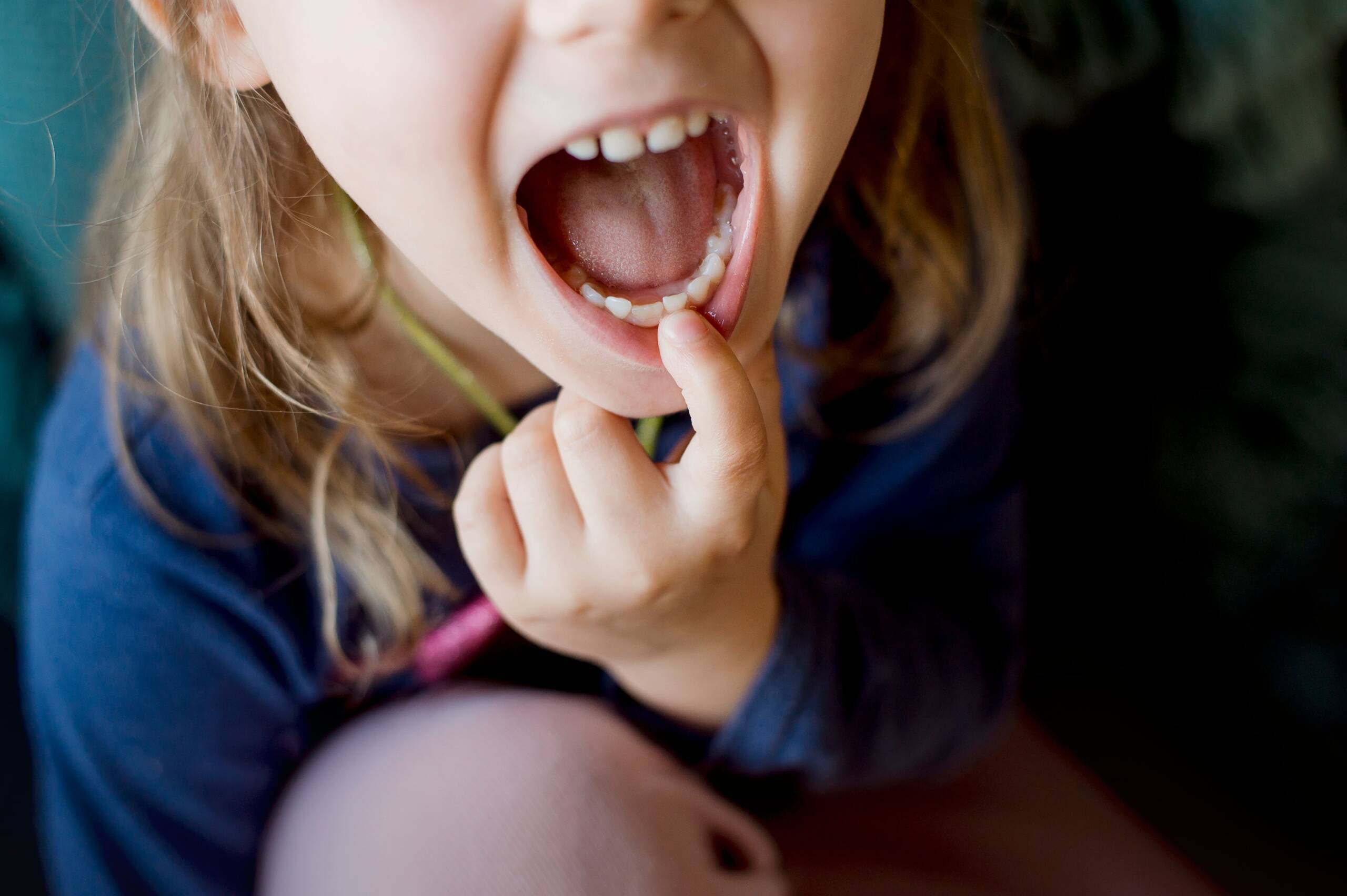 pediatric dentistry patient showing a loose tooth